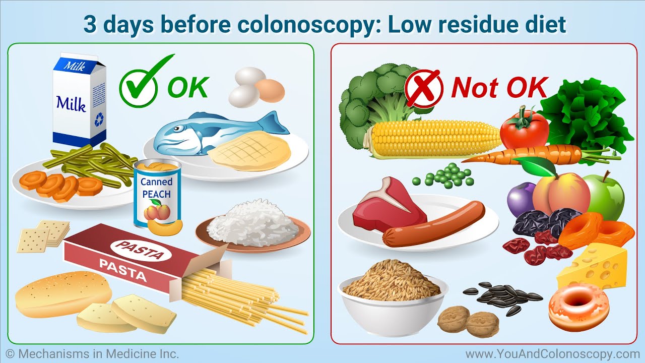 Healthy foods for colonoscopy preparation